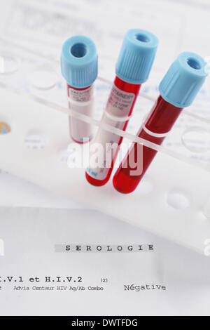 AIDS-screening Stockfoto