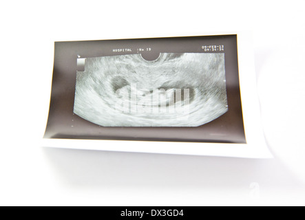 12 Wochen Baby Ultraschall Bild Stockfoto