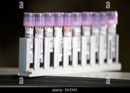 Blut probieren Flaschen in das Blut Testlabor am Heartlands Hospital in Birmingham abgebildet. Stockfoto