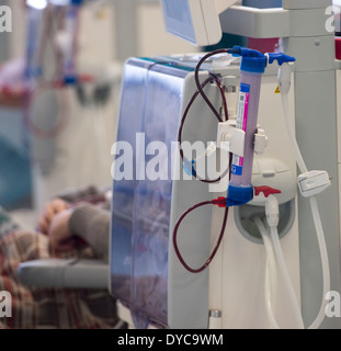 Eine Niere Dialysepatient erhält Behandlung von Nierenversagen in einem NHS Krankenhaus. Stockfoto