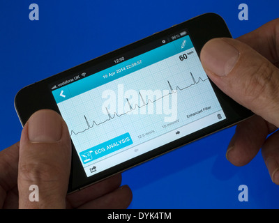 Benutzer mit tragbaren EKG EKG Herz Monitor App läuft auf iPhone 4 zeigt normale Sinusrhythmus Herz mit einem ektopische Herzschlag Stockfoto