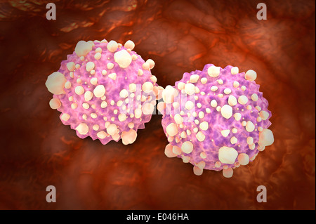 Microscipic Ansicht der pankreatischen Krebszellen. Stockfoto