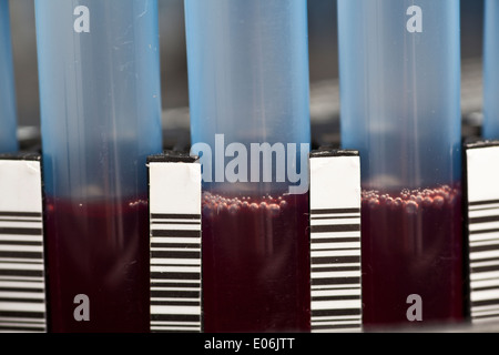 Probe im Labor Zentrifuge Blood - Nahaufnahme Stockfoto