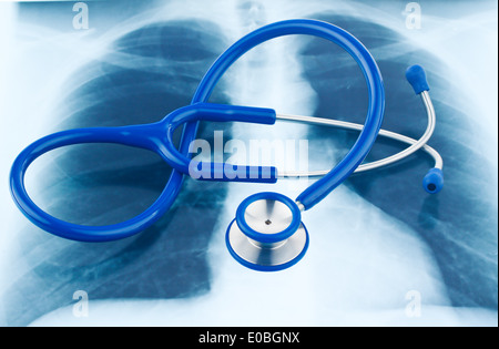 Ein Stethoskop und ein Röntgenbild. Symbol für Gesundheit, Ein Stethoskop Und Ein Roentgenbild. Symbol Fuer Gesundheit. Stockfoto