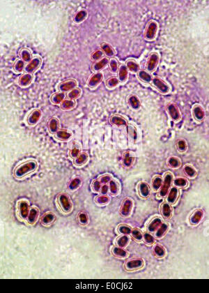 Streptococcus pneumoniae Stockfoto