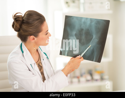 Arzt Frau zeigt auf fluorography Stockfoto