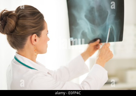 Arzt Frau zeigt auf fluorography Stockfoto