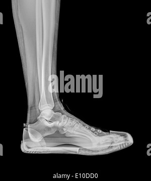 X-ray eine Fuß- und Sprunggelenk in einen trainer Stockfoto
