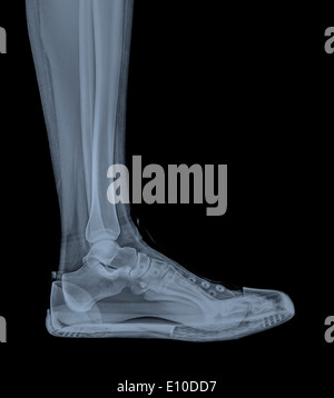 X-ray eine Fuß- und Sprunggelenk in einen trainer Stockfoto