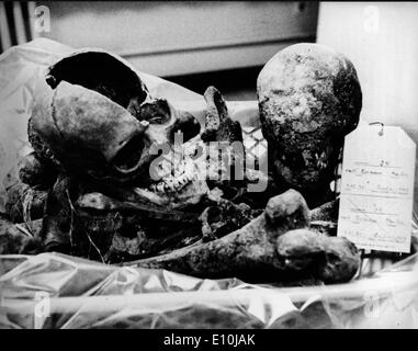 Zwei Knochen, einen Schädel und Oberschenkel, wurden bei Ausgrabungen in Berlins Lehrt Station gefunden. Stockfoto