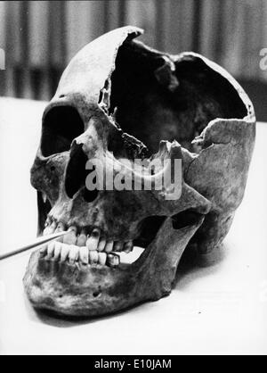 Zwei Knochen, einen Schädel und Oberschenkel, wurden bei Ausgrabungen in Berlins Lehrt Station gefunden. Stockfoto