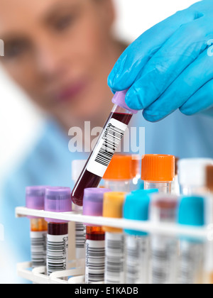 Wissenschaftler halten Blutprobe in einem Reagenzglas-Gestell. Stockfoto