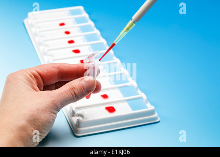 Person fallen Blutprobe in ein Fläschchen mit einer Pipette. Stockfoto