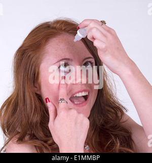 Frau Anwendung Latanoprost Auge Tropfen für die Behandlung des Glaukoms, die die Lösung für jedes Auge angewendet wird Stockfoto