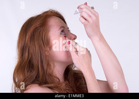 Frau Anwendung Latanoprost Auge Tropfen für die Behandlung des Glaukoms, die die Lösung für jedes Auge angewendet wird Stockfoto