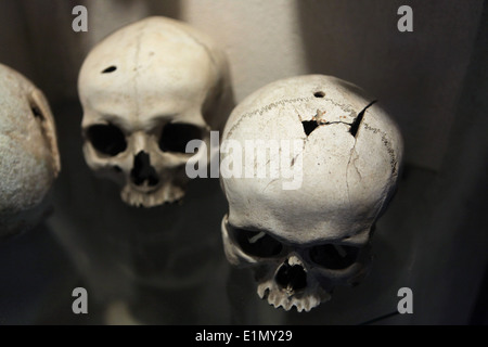 Menschliche Schädel beschädigt durch Achsen während der Hussitenkriege in Sedlec Ossuary in Kutna Hora, Tschechien gesehen. Stockfoto