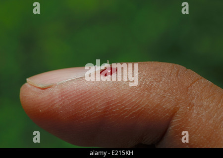 Blutfleck auf Finger nach einem Biss der Pferdebremse Stockfoto