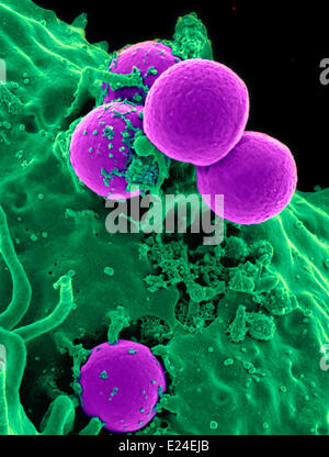 Menschlichen Neutrophilen Einnahme mrsa Stockfoto