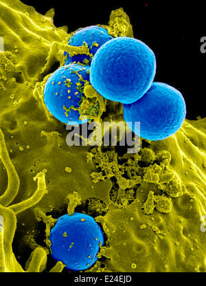 Menschlichen Neutrophilen Einnahme mrsa Stockfoto