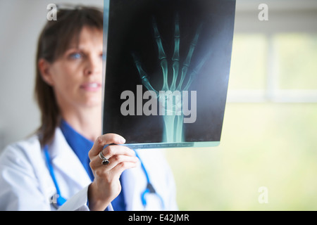 Arzt, die Röntgenaufnahme der Hand betrachten Stockfoto