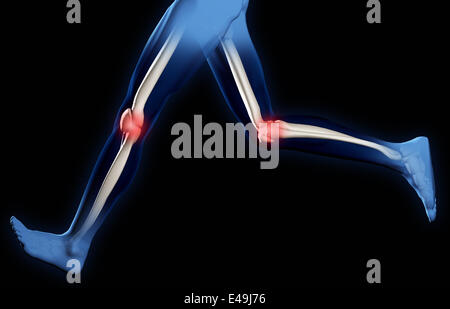 Schmerzen in den Kniegelenken Stockfoto