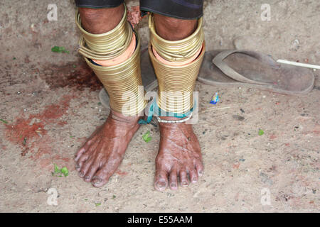 Padaung Frau mit traditionellen Bein Ring, Thailand Stockfoto