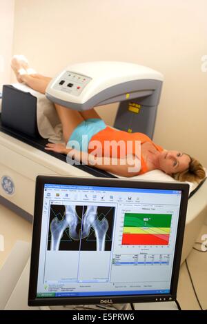 Ein Arzt benutzt ein Knochen Densitometer zur Messung der optischen Dichte des Halses des Oberschenkelknochens der Patientin zu diagnostizieren Stockfoto