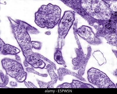 Transmission Electron Schliffbild (TEM) von Mumps-Viren, diese RNA-Virus ist ein Rubulavirus, Mitglied der Paramyxovirus. Stockfoto