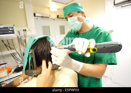 Ein Meningeom (gutartiger Hirntumor) mit einem Gamma Knife Behandlung, ist auf den Kopf des Patienten mit ein stereotaktischen Rahmens fixiert. Stockfoto