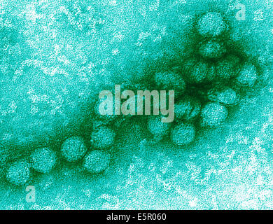 Elektron Schliffbild des West-Nil-Virus, das RNA-Virus ist ein Flavivirus (Flaviviridae) verantwortlich für das West-Nil-Fieber. Stockfoto