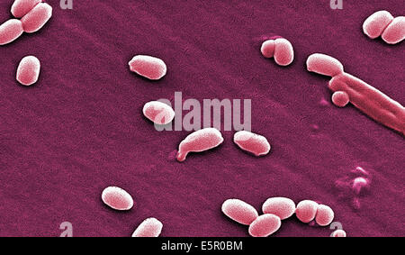 Elektron Schliffbild der Sporen von Bacillus Anthracis, eine grampositiven Arten von Bakterien ist hoch pathogenen und verursacht Stockfoto