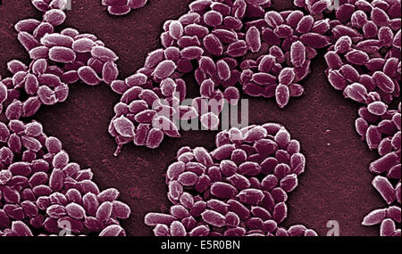 Elektron Schliffbild der Sporen von Bacillus Anthracis, eine grampositiven Arten von Bakterien ist hoch pathogenen und verursacht Stockfoto