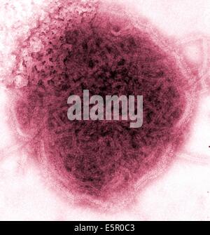 Transmission Electron Schliffbild (TEM) des Mumps-Virus. Stockfoto