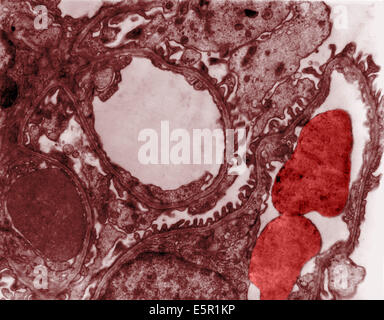 Transmission Electron Schliffbild (TEM) OS einen Abschnitt von einem Glomerulus, der runden Formen in der Mitte und rechts sind Blutgefäße Stockfoto