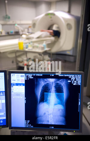 Patienten Herz 3D CT-Scan, Department of Medical Imaging, Zentrum Cardiologique du Nord, Saint-Denis, Frankreich. Stockfoto