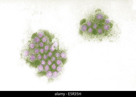 Elektron Schliffbild des Norwalk Virus, ein RNA-Virus der Gattung Norovirus (Caliciviridae) verantwortlich für Gastroenteritis. Stockfoto