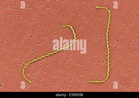 Farbe verstärkt scanning Electron Schliffbild (SEM) von Leptospira Interrogans Stamm RGA. Stockfoto