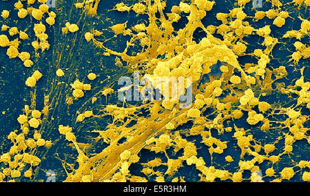 Farbe verstärkt scanning Electron Schliffbild der Staphylococcus Biofilm auf der inneren Oberfläche eines nadelfreie Connectors. Stockfoto