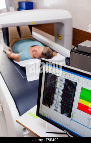 Messung der optischen Dichte der unteren Rachis (Backbone) der Patientin zur diagnose von Osteoporose Knochendichtemessung. Stockfoto