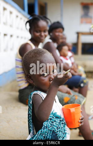 Unterernährten Kind leidet an Kwashiorkor in einem therapeutischen Feeding Center in Monrovia, Liberia, durchgeführten Aktion Stockfoto