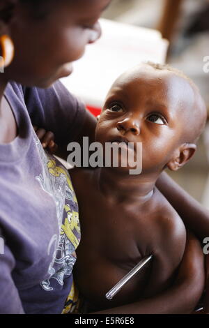 Überprüfen die Temperatur der Kinder leiden unter Mangelernährung in einem therapeutischen Feeding Center in Monrovia, Liberia, Stockfoto