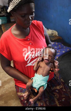 Frau mit ihrem unterernährten Kind in einem therapeutischen Ernährungszentrum in Monrovia, Liberia, umgesetzt von Action Contre la Faim Stockfoto