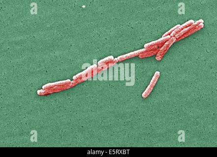 Eingefärbte scanning Electron Schliffbild (SEM) dargestellt, eine Reihe von Gram-negativen Legionella Pneumophila Bakterien, Vergrößerung Stockfoto