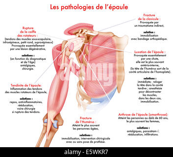 Schulter, Abbildung Stockfoto