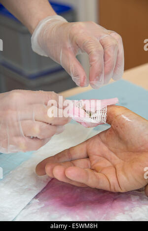 Wundversorgung Stockfoto