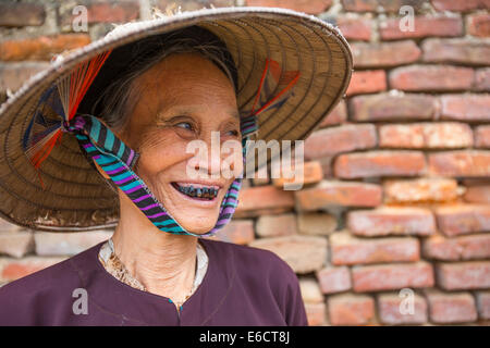 Vietnamesin mit schwarzen Zähnen aus Kauen von Betelnüssen in Hanoi lange Khe Dorf Stockfoto