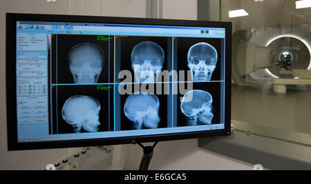 Dresden, Deutschland. 22. August 2014. Die Methode der Protonen Behandlungseinheit präsentiert auf einem Monitor vor die offiziellen Einweihung im "OncoRay - Nationales Zentrum Fuer Strahlenforschung" (lit.) OncoRay - nationales Zentrum für Radiologie) am Universitätsklinikum Carl Gutsav Carus in Dresden, Deutschland, 22. August 2014. Der Behandlungsraum für Kinder-Krebs-Patienten ist voll funktionsfähig und braucht nur eine administrative Abnahme. Foto: Arno Burgi/Dpa/Alamy Live-Nachrichten Stockfoto