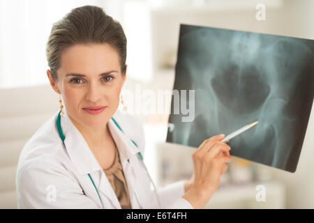 Porträt der Arzt Frau zeigt auf fluorography Stockfoto