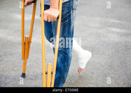 Nahaufnahme des Beines auf Bandage mit Krücken Stockfoto