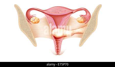 Gebärmutterhalskrebs, Zeichnung Stockfoto